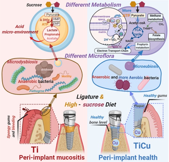 含铜抗菌钛合金研究取得重要进展